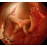 Abortion Unborn